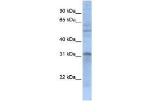 WB Suggested Anti-MTCH2  Antibody Titration: 0. (MTCH2 anticorps  (N-Term))