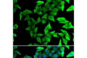 Immunofluorescence analysis of U2OS cells using VSNL1 Polyclonal Antibody (VSNL1 anticorps)