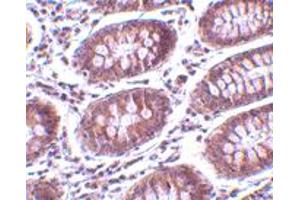 Immunohistochemistry of MICA in human colon tissue with MICA polyclonal antibody  at 10 ug/mL . (MICA anticorps  (C-Term))