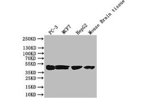 Western Blot Positive WB detected in: PC-3 whole cell lysate, Mouse liver tissue All lanes: DGAT2 antibody at 3 μg/mL Secondary Goat polyclonal to rabbit IgG at 1/50000 dilution Predicted band size: 44, 40 kDa Observed band size: 44 kDa (DGAT2 anticorps  (AA 1-66))