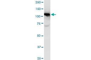 CAND1 polyclonal antibody (A01), Lot # 051005JC01. (CAND1 anticorps  (AA 1-100))