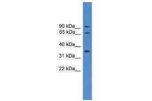 Western Blot showing CCIN antibody used at a concentration of 1-2 ug/ml to detect its target protein. (Calicin anticorps  (N-Term))