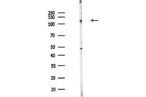 anti-Hect Domain and RLD 3 (HERC3) antibody
