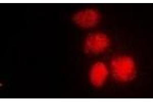 Immunofluorescent analysis of XPV staining in HepG2 cells. (POLH anticorps)