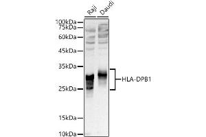 Western blot analysis of extracts of various cell lines, using HLA-DPB1 antibody (ABIN7268370) at 1:1000 dilution. (HLA-DPB1 anticorps)