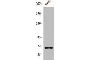Western Blot analysis of HuvEc cells using CTPS Polyclonal Antibody (CTP Synthase anticorps  (N-Term))