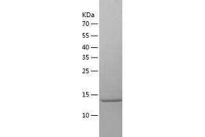 Western Blotting (WB) image for Ubiquitin-Conjugating Enzyme E2 Variant 2 (UBE2V2) (AA 2-145) protein (His-IF2DI Tag) (ABIN7125603)