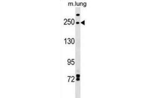 Western Blotting (WB) image for anti-Inverted Formin, FH2 and WH2 Domain Containing (INF2) antibody (ABIN2999620) (INF2 anticorps)