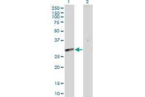 Western Blot analysis of SLC25A5 expression in transfected 293T cell line by SLC25A5 MaxPab polyclonal antibody. (SLC25A5 anticorps  (AA 1-298))