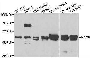 Western blot analysis of extracts of various cell lines, using PAX6 antibody. (PAX6 anticorps  (AA 1-300))