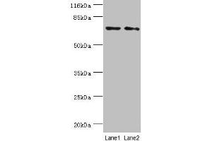 Western blot All lanes: MAGEC3 antibody at 2 μg/mL Lane 1: A375 whole cell lysate Lane 2: Rat thymus tissue Secondary Goat polyclonal to rabbit IgG at 1/10000 dilution Predicted band size: 72, 39 kDa Observed band size: 72 kDa (MAGEC3 anticorps  (AA 75-197))