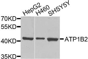 Western blot analysis of extracts of various cells, using ATP1B2 antibody. (ATP1B2 anticorps)