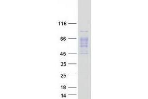 Validation with Western Blot