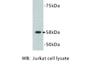 Image no. 1 for anti-Deoxynucleotidyltransferase, terminal (DNTT) antibody (ABIN1112828)