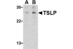 Western blot analysis of TSLP in Jurkat cell lysate with this product at (A) 1 and (B) 2 μg/ml. (Thymic Stromal Lymphopoietin anticorps  (C-Term))