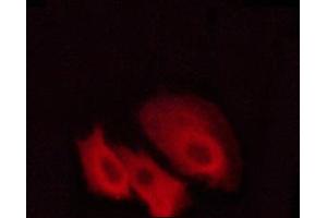 ABIN6267408 staining Hela cells by ICC/IF.