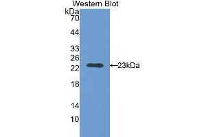 Western Blotting (WB) image for anti-Slow Skeletal Troponin I (TNNI1) (AA 1-187) antibody (ABIN1176057) (TNNI1 anticorps  (AA 1-187))