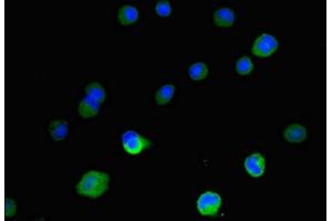 Immunofluorescent analysis of MCF-7 cells using ABIN7156360 at dilution of 1:100 and Alexa Fluor 488-congugated AffiniPure Goat Anti-Rabbit IgG(H+L)
