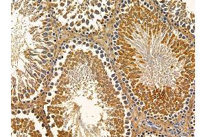 ABIN7095754 and ABIN7099816 at 1/100 staining rat testis tissue by IHC-P. (ERVK-18 anticorps)