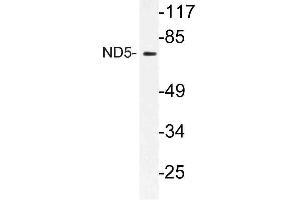 Western blot (WB) analysis of ND5 antibody in extracts from HT-29 cells. (MT-ND5 anticorps)