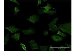 Immunofluorescence of monoclonal antibody to DLX5 on HeLa cell.