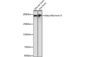 Western blot analysis of extracts of various cell lines, using Neurofilament H antibody (ABIN7268866) at 1:500 dilution. (NEFH anticorps)