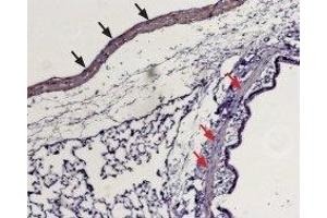 Expression of Sphingosine 1-phosphate receptor 1 in rat lung - Immunohistochemical staining of paraffin embedded rat lung sections using Anti-S1PR1 (EDG1) (extracellular) Antibody (ABIN7043771, ABIN7045270 and ABIN7045271), (1:100).