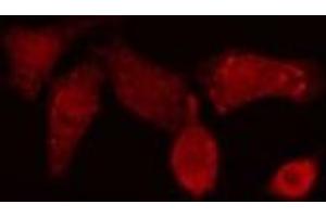 ABIN6276815 staining NIH-3T3 cells by IF/ICC. (POLB anticorps  (C-Term))