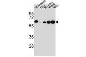 Western blot analysis of Haptoglobin Antibody (Center) in MDA-MB453,CEM,NCI-H460,HepG2,K562 cell line lysates (35ug/lane).