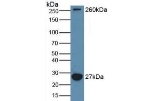 Detection of MAP1A in Mouse Brain Tissue using Polyclonal Antibody to Microtubule Associated Protein 1A (MAP1A)