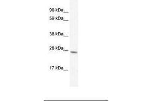 Image no. 2 for anti-General Transcription Factor IIF, Polypeptide 2, 30kDa (GTF2F2) (C-Term) antibody (ABIN6735897) (GTF2F2 anticorps  (C-Term))