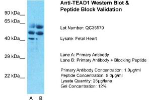 Host: Rabbit Target Name: TEAD1 Sample Type: Human Fetal Muscle Lane A: Primary Antibody Lane B: Primary Antibody + Blocking Peptide Primary Antibody Concentration: 1ug/ml Peptide Concentration: 5ug/ml Lysate Quantity: 25ug/lane/lane Gel Concentration: 0.