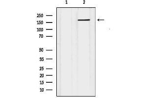 Western blot analysis of lysates from HUVEC, using ABCC5 Antibody.