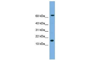 IL1 beta antibody used at 1 ug/ml to detect target protein. (IL-1 beta anticorps  (N-Term))