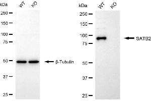 Western blotting analysis using SATB2 antibody (ABIN7800274).