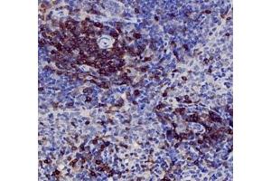 Immunohistochemistry of paraffin embedded rat spleen using CD3 (ABIN7073386) at dilution of 1: 1000 (400x lens)