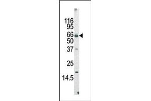 Image no. 1 for anti-Protein AF-9 (MLLT3) (Middle Region) antibody (ABIN358674)