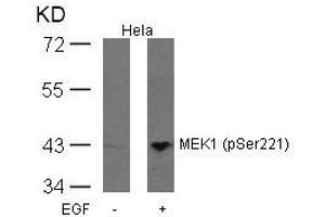 Western blot analysis of extracts from Hela cells untreated or treated with EGF using MEK1(Phospho-Ser221) Antibody. (MEK1 anticorps  (pSer221))