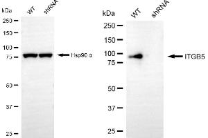 Western blotting analysis using ITGB5 antibody (ABIN7799074). (Recombinant Integrin beta 5 anticorps)
