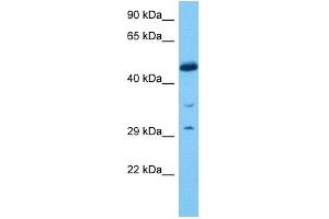 Host:  Rat  Target Name:  EGR2  Sample Tissue:  Rat Skeletal Muscle  Antibody Dilution:  1ug/ml