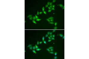 Immunofluorescence (IF) image for anti-Thioredoxin-Like 1 (TXNL1) antibody (ABIN1980338)