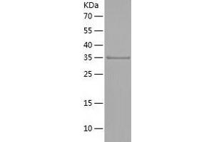 Western Blotting (WB) image for NADH Dehydrogenase (Ubiquinone) 1 alpha Subcomplex, Assembly Factor 1 (NDUFAF1) (AA 25-327) protein (His-IF2DI Tag) (ABIN7124104)