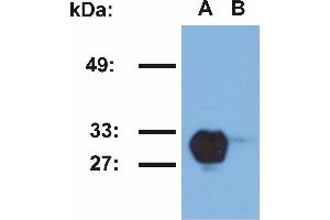 Western blotting analysis of HLA-DR1 in Raji (A) and Jurkat (B) cell lines using MEM-267 antibody.