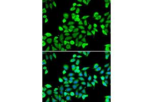 Immunofluorescence analysis of A549 cell using CDC16 antibody. (CDC16 anticorps)