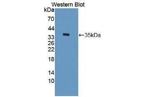 Western blot analysis of the recombinant protein. (TKT anticorps  (AA 1-286))