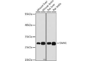 Western blot analysis of extracts of various cell lines, using SMN1 antibody (ABIN7270652) at 1:1000 dilution. (SMN1 anticorps  (AA 80-150))