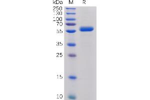 Human CTLA-4 Protein, mFc-His Tag on SDS-PAGE under reducing condition.