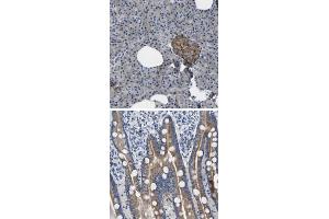 Immunohistochemical staining of human duodenum with TOR1B polyclonal antibody  shows moderate cytoplasmic positivity in glandular cells. (TOR1B anticorps)