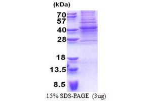 SDS-PAGE (SDS) image for Paired Box 9 (PAX9) (AA 1-341) protein (His tag) (ABIN5853281) (PAX9 Protein (AA 1-341) (His tag))