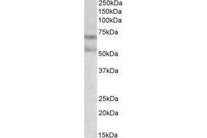 Western Blotting (WB) image for anti-Cannabinoid Receptor 1 (CNR1) (AA 77-91) antibody (ABIN793332) (CNR1 anticorps  (AA 77-91))